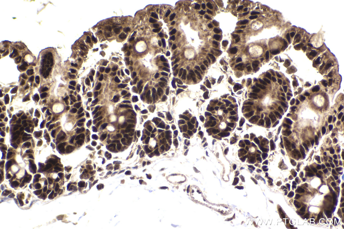 Immunohistochemical analysis of paraffin-embedded mouse small intestine tissue slide using KHC2204 (CDC2L1 IHC Kit).