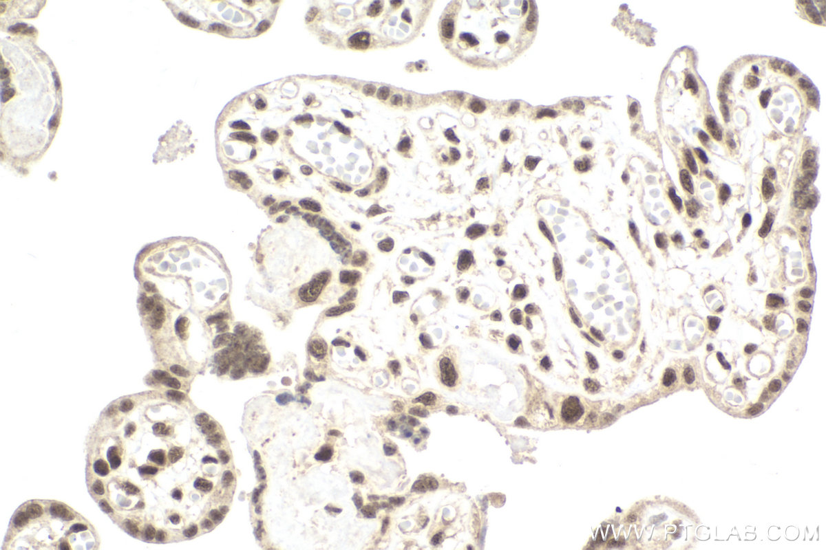 Immunohistochemical analysis of paraffin-embedded human placenta tissue slide using KHC2204 (CDC2L1 IHC Kit).