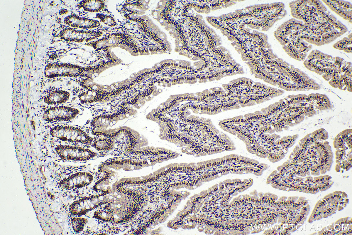 Immunohistochemical analysis of paraffin-embedded rat small intestine tissue slide using KHC2204 (CDC2L1 IHC Kit).