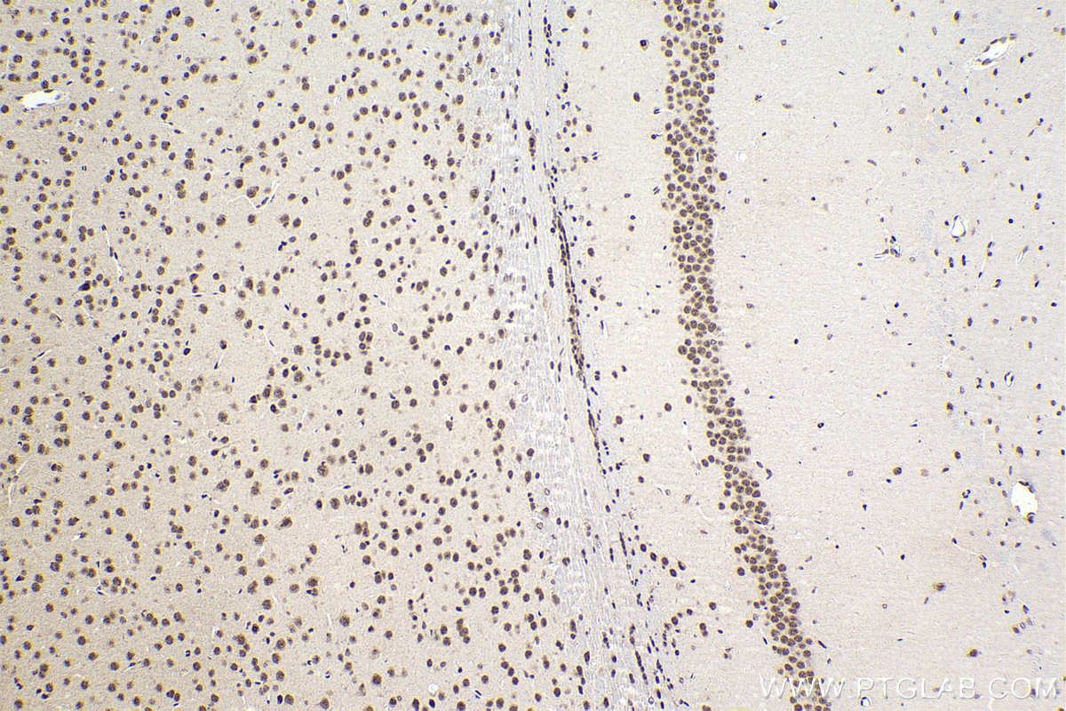 Immunohistochemical analysis of paraffin-embedded mouse brain tissue slide using KHC2204 (CDC2L1 IHC Kit).