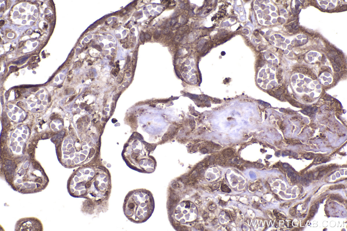 Immunohistochemical analysis of paraffin-embedded human placenta tissue slide using KHC2336 (CDC42 IHC Kit).