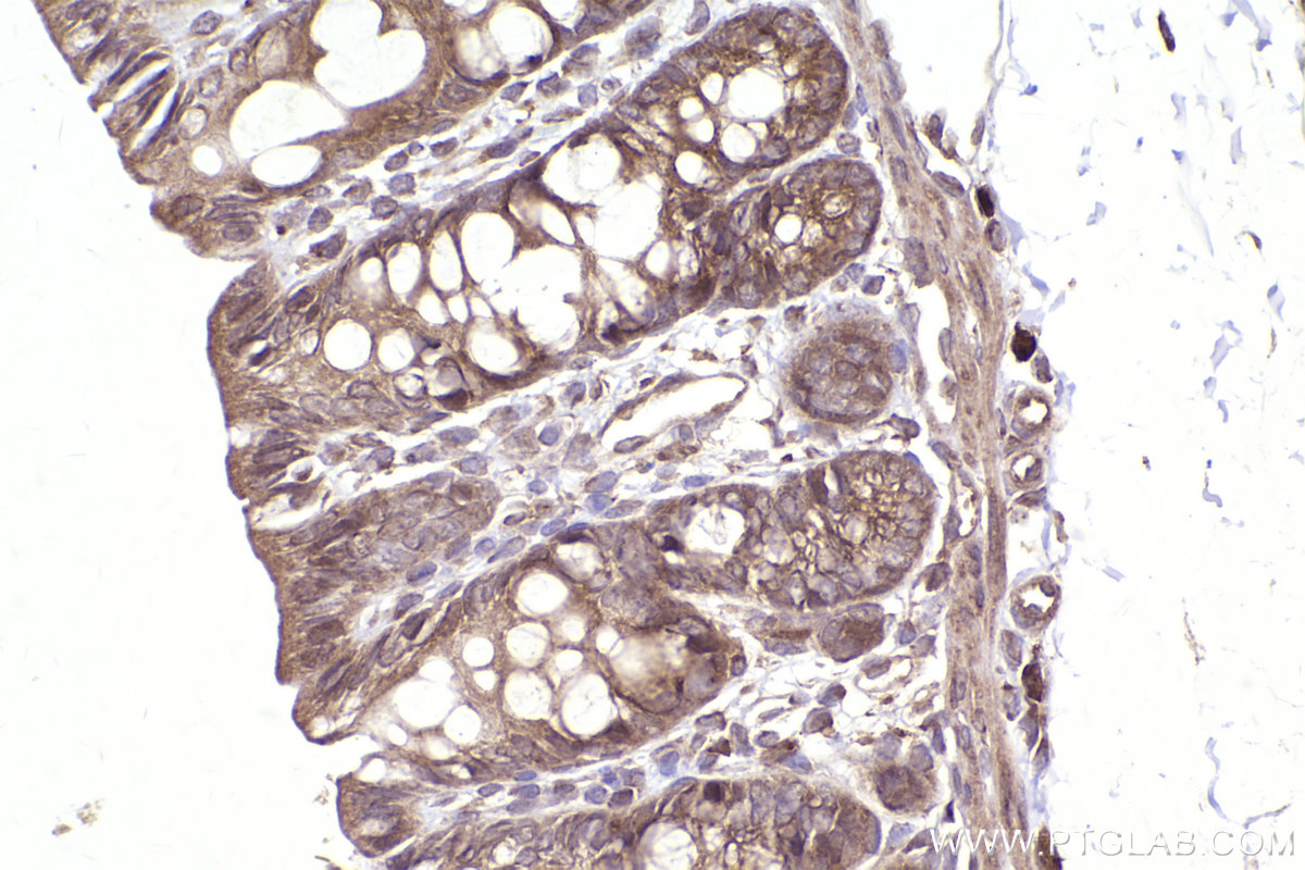 Immunohistochemical analysis of paraffin-embedded rat colon tissue slide using KHC2480 (CDK10 IHC Kit).