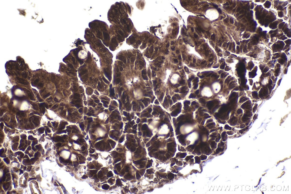 Immunohistochemical analysis of paraffin-embedded mouse intestine tissue slide using KHC2212 (CDK2 IHC Kit).