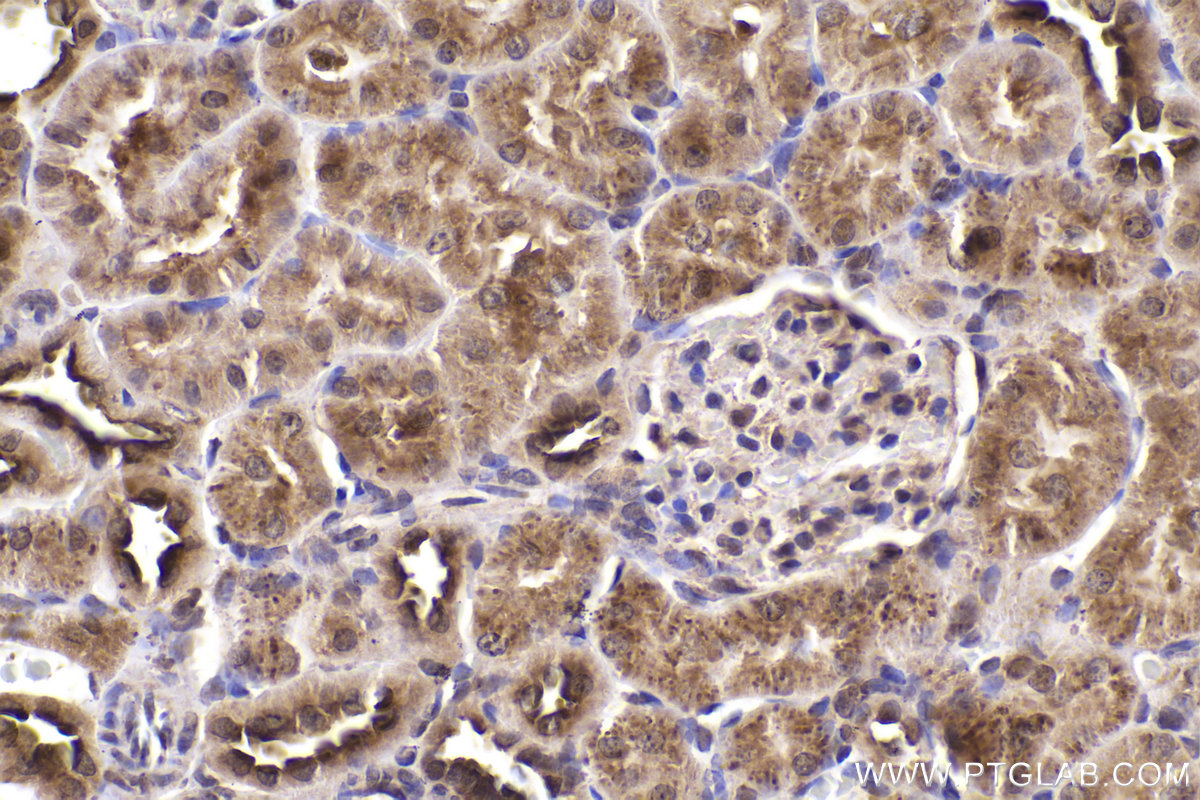 Immunohistochemical analysis of paraffin-embedded rat kidney tissue slide using KHC2212 (CDK2 IHC Kit).