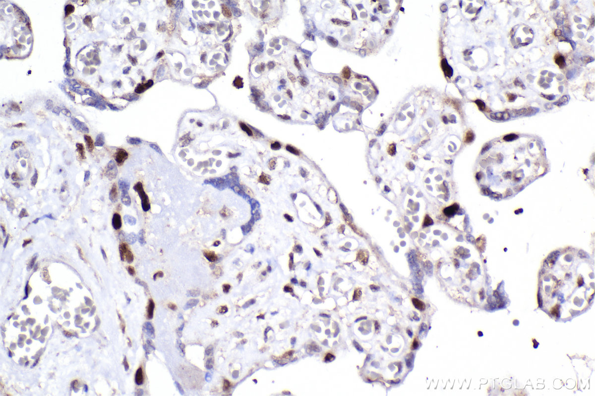 Immunohistochemical analysis of paraffin-embedded human placenta tissue slide using KHC2295 (CDKN1C IHC Kit).