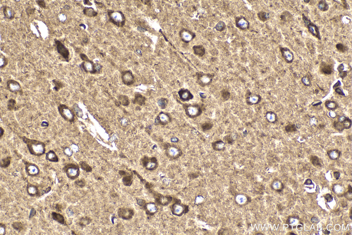 Immunohistochemical analysis of paraffin-embedded mouse brain tissue slide using KHC2146 (CDS2 IHC Kit).