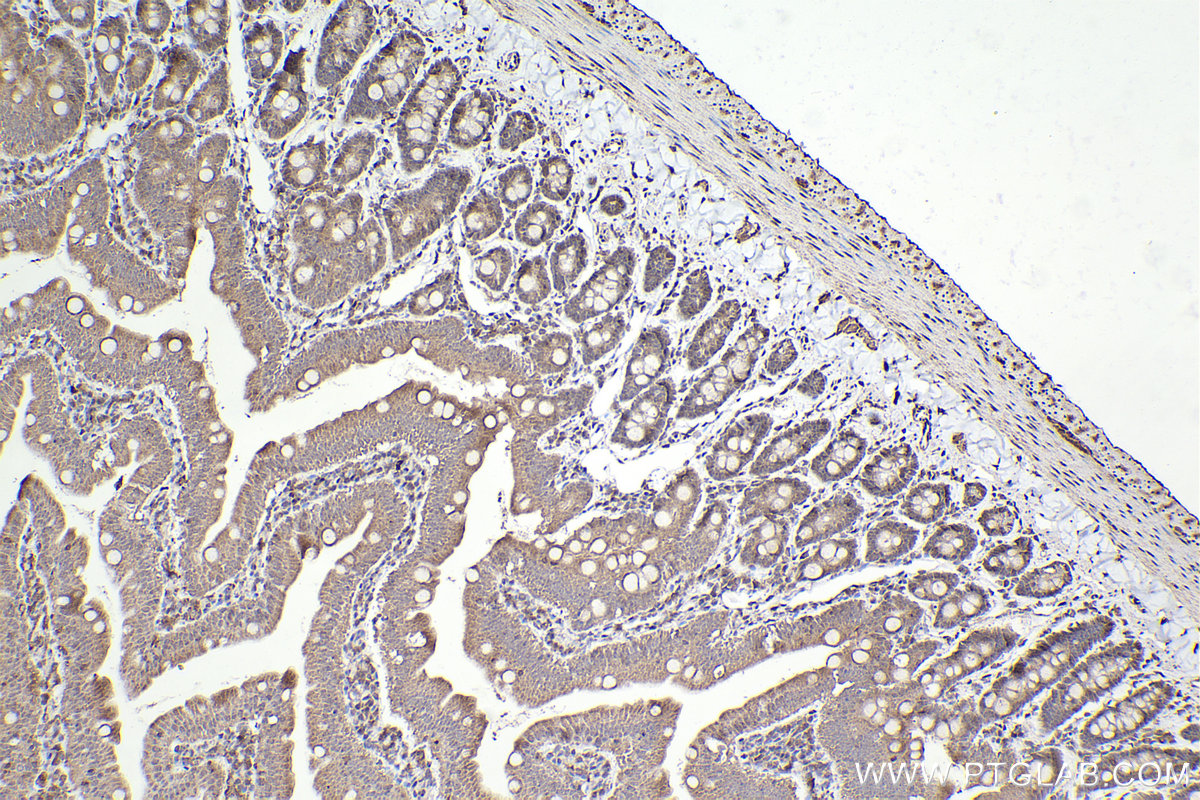 Immunohistochemical analysis of paraffin-embedded rat small intestine tissue slide using KHC2217 (CHAT IHC Kit).