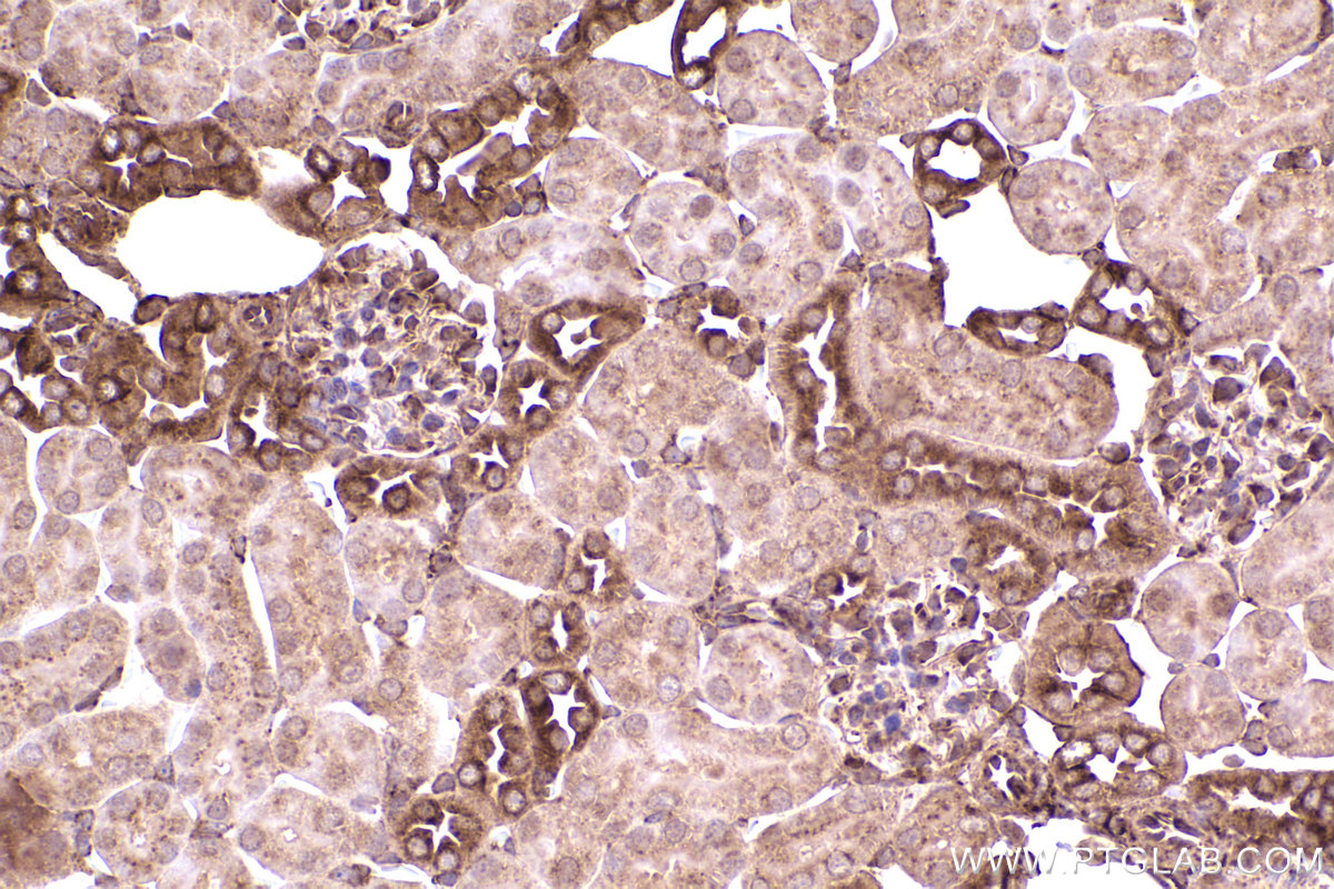 Immunohistochemical analysis of paraffin-embedded mouse kidney tissue slide using KHC2399 (CKAP4 IHC Kit).