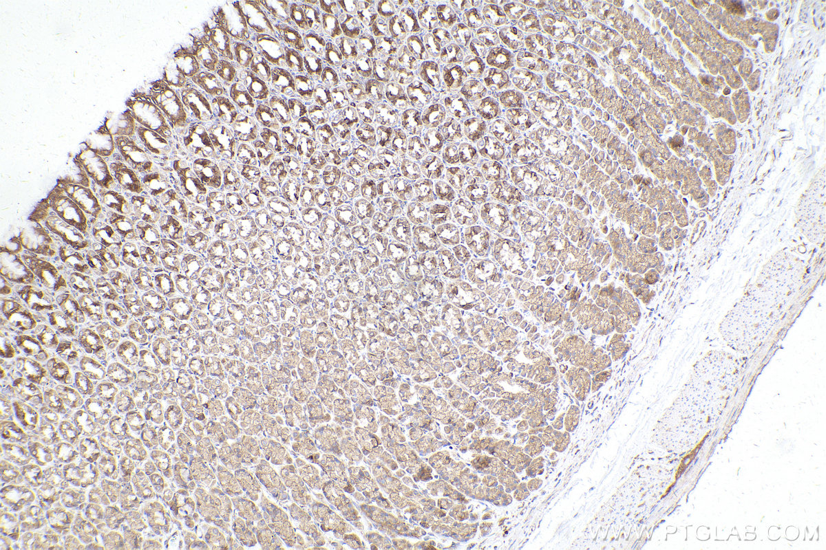 Immunohistochemical analysis of paraffin-embedded rat stomach tissue slide using KHC2444 (CKAP5/Ch-TOG IHC Kit).