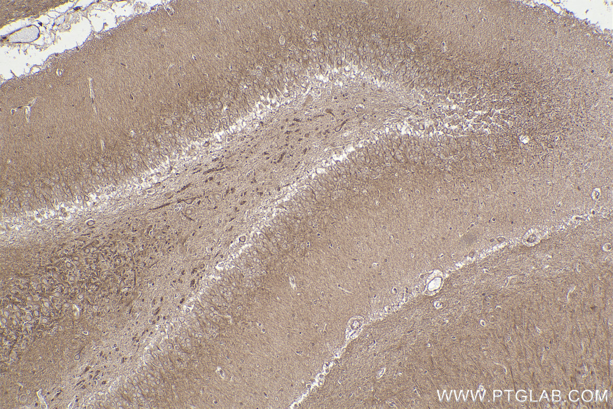 Immunohistochemical analysis of paraffin-embedded rat brain tissue slide using KHC2230 (CLIP1 IHC Kit).