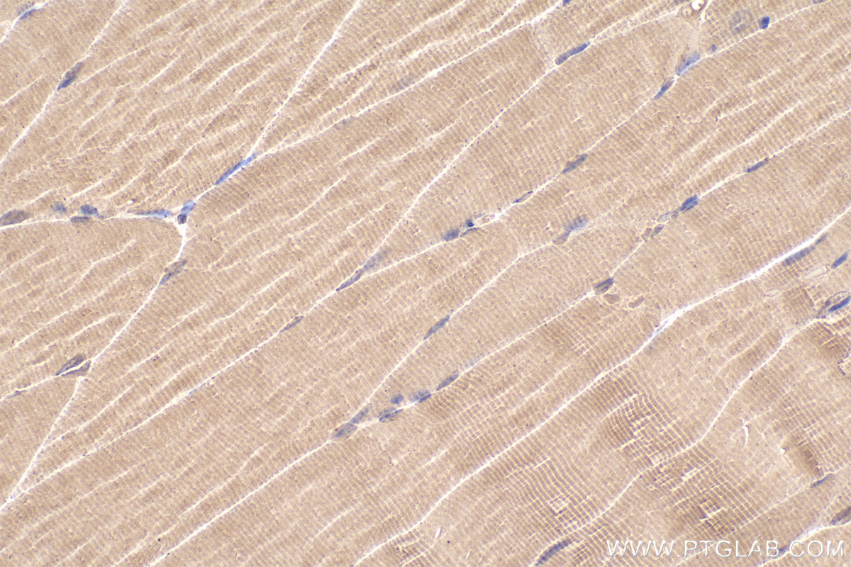 Immunohistochemical analysis of paraffin-embedded mouse skeletal muscle tissue slide using KHC2319 (CLTCL1 IHC Kit).