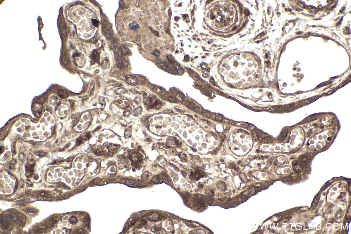 Immunohistochemical analysis of paraffin-embedded human placenta tissue slide using KHC2018 (CNOT6 IHC Kit).