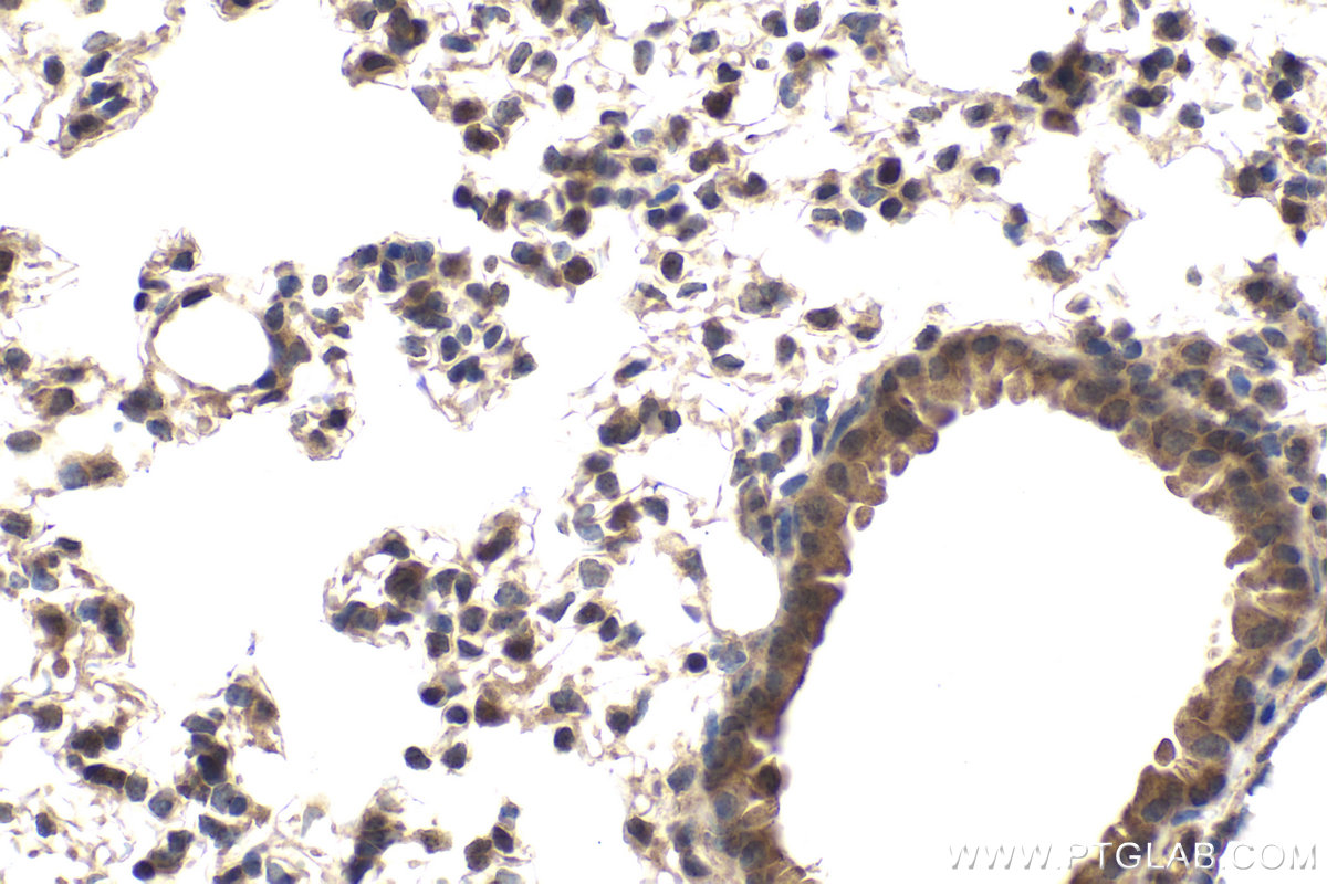 Immunohistochemical analysis of paraffin-embedded mouse lung tissue slide using KHC2018 (CNOT6 IHC Kit).
