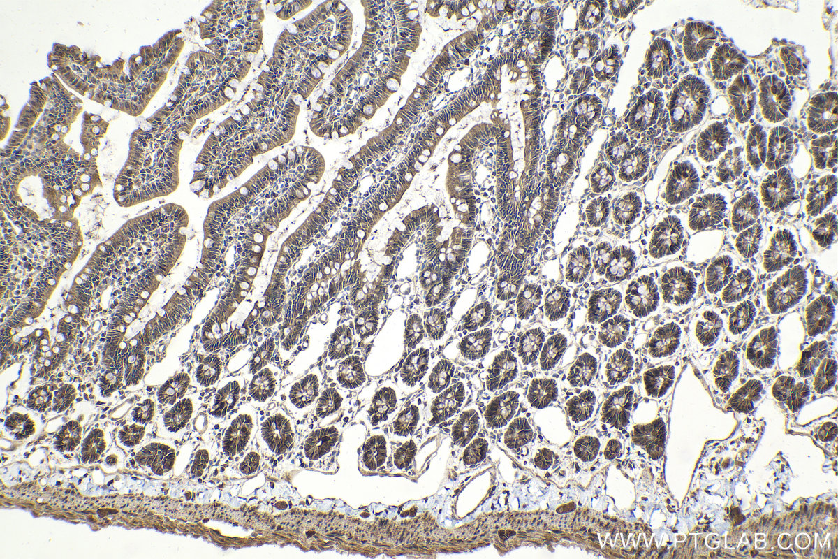 Immunohistochemical analysis of paraffin-embedded rat small intestine tissue slide using KHC2018 (CNOT6 IHC Kit).