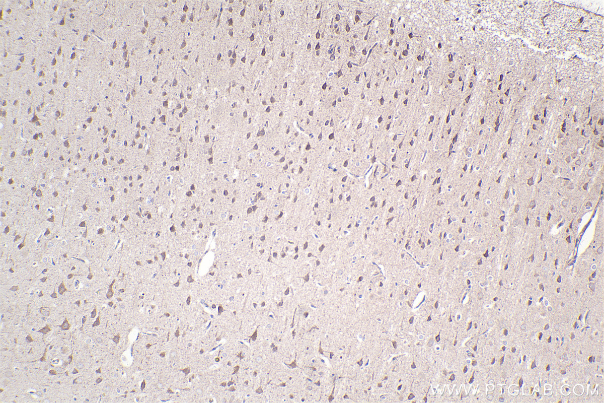 Immunohistochemical analysis of paraffin-embedded rat brain tissue slide using KHC2371 (COG7 IHC Kit).