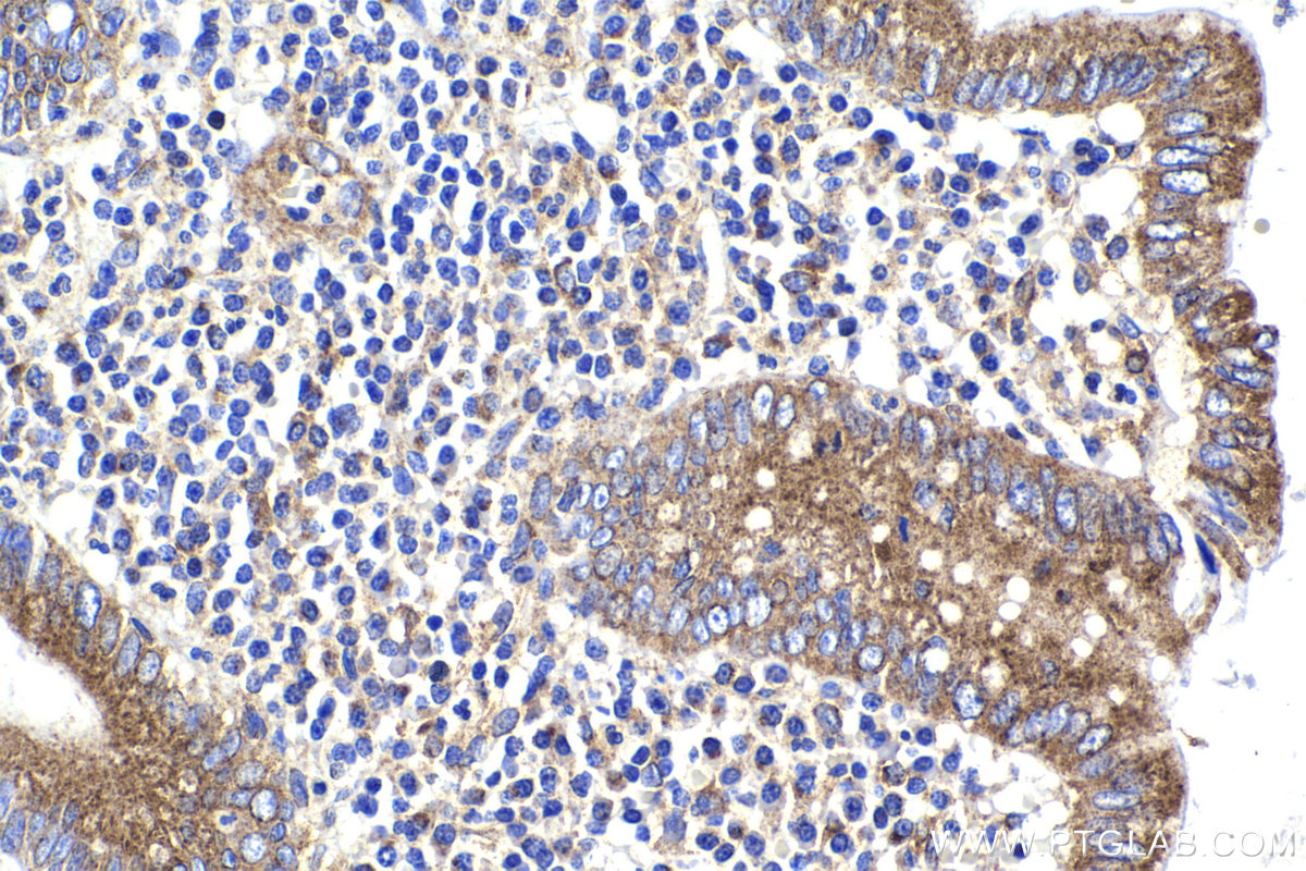 Immunohistochemical analysis of paraffin-embedded human appendicitis tissue slide using KHC2316 (COPA IHC Kit).