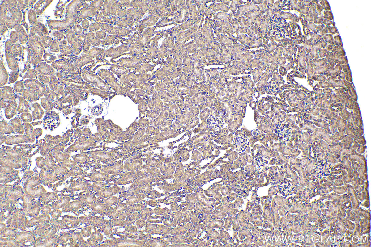 Immunohistochemical analysis of paraffin-embedded mouse kidney tissue slide using KHC2315 (COPB1 IHC Kit).