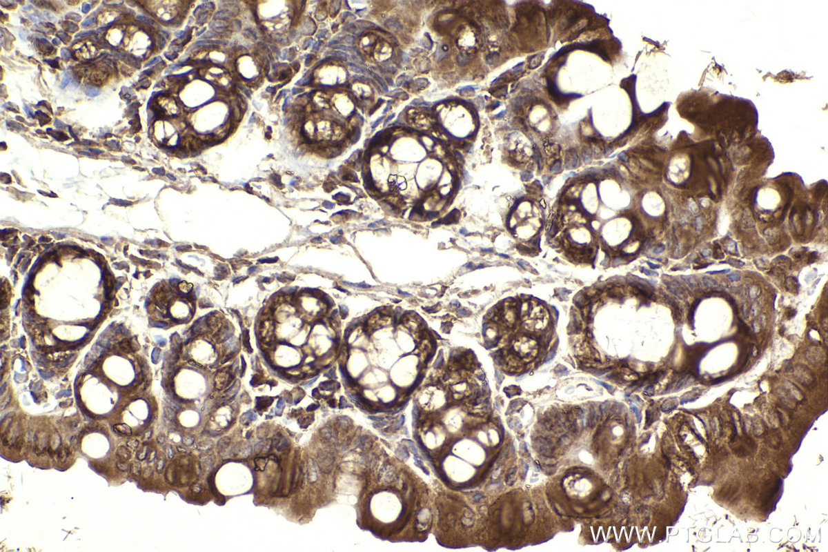 Immunohistochemical analysis of paraffin-embedded mouse intestin tissue slide using KHC2315 (COPB1 IHC Kit).