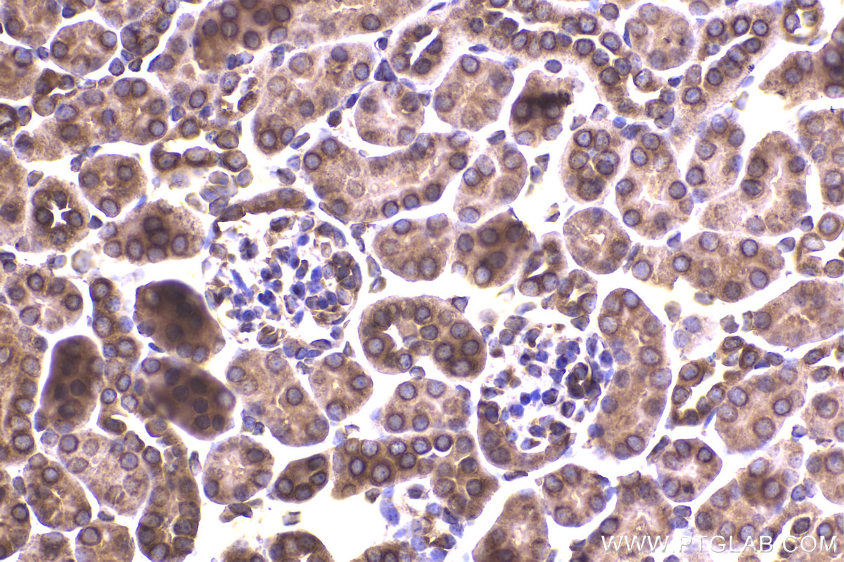 Immunohistochemical analysis of paraffin-embedded mouse kidney tissue slide using KHC2247 (COPB2 IHC Kit).