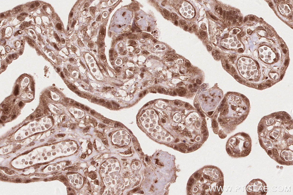 Immunohistochemical analysis of paraffin-embedded human placenta tissue slide using KHC2614 (COPS6 IHC Kit).