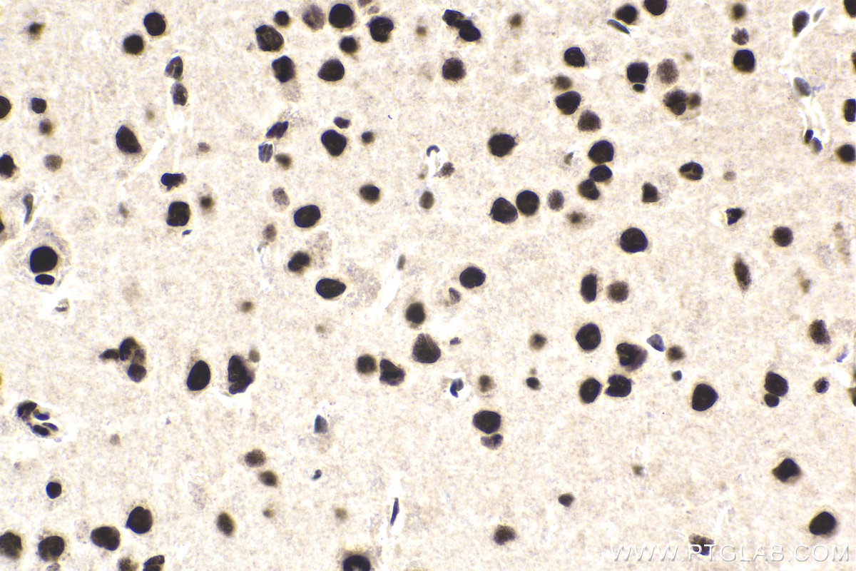 Immunohistochemical analysis of paraffin-embedded mouse brain tissue slide using KHC1974 (CPSF2 IHC Kit).