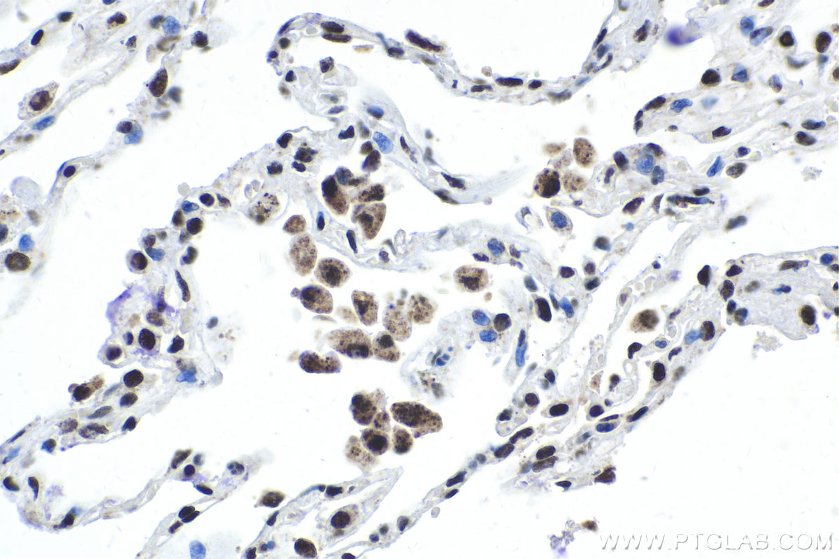 Immunohistochemical analysis of paraffin-embedded human lung tissue slide using KHC1974 (CPSF2 IHC Kit).