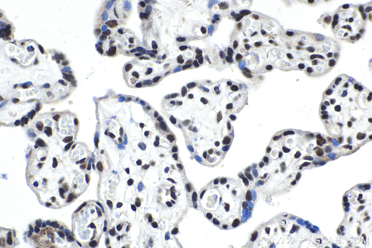Immunohistochemical analysis of paraffin-embedded human placenta tissue slide using KHC1974 (CPSF2 IHC Kit).