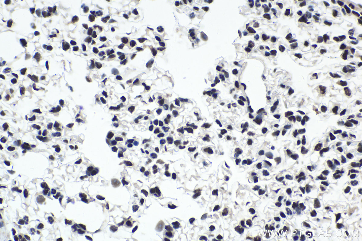 Immunohistochemical analysis of paraffin-embedded mouse lung tissue slide using KHC1974 (CPSF2 IHC Kit).