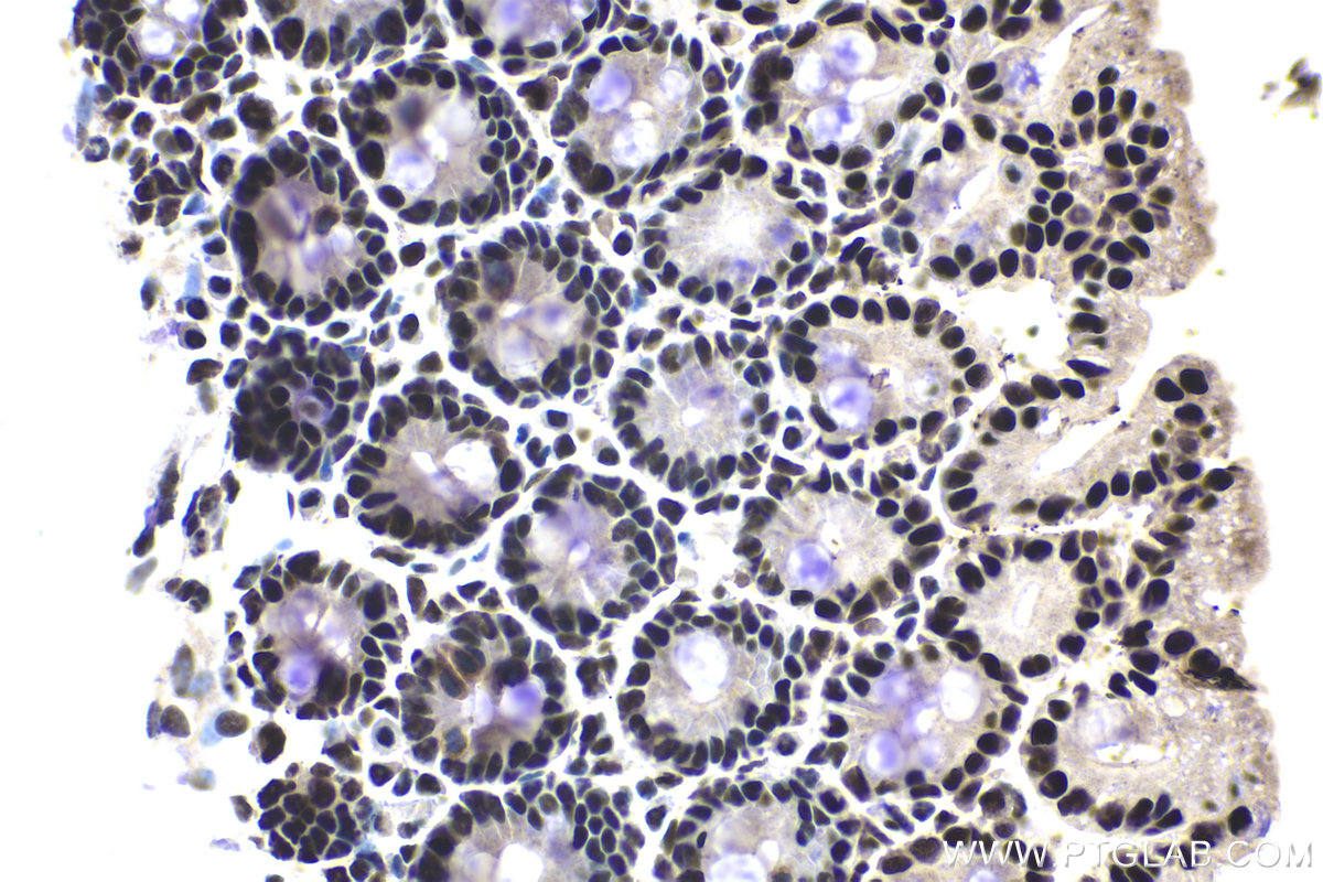Immunohistochemical analysis of paraffin-embedded mouse small intestine tissue slide using KHC1974 (CPSF2 IHC Kit).