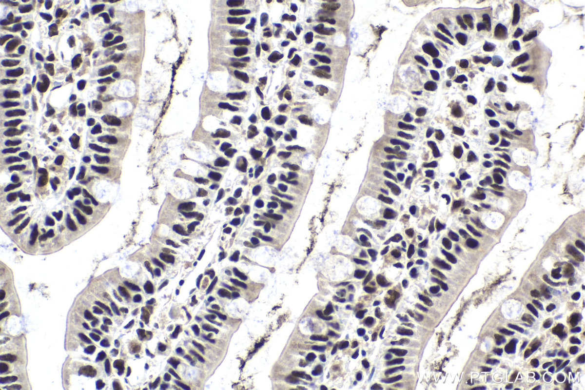 Immunohistochemical analysis of paraffin-embedded rat small intestine tissue slide using KHC1974 (CPSF2 IHC Kit).