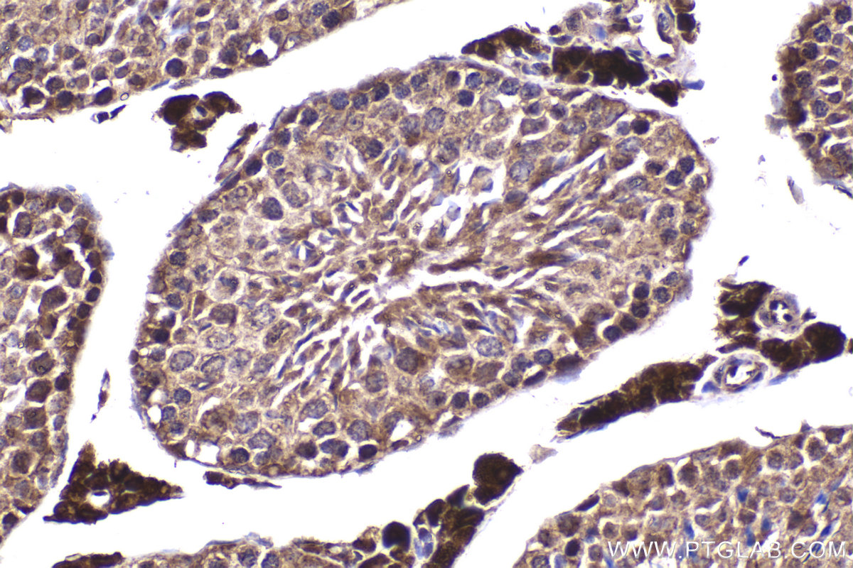 Immunohistochemical analysis of paraffin-embedded mouse testis tissue slide using KHC2259 (CSK IHC Kit).