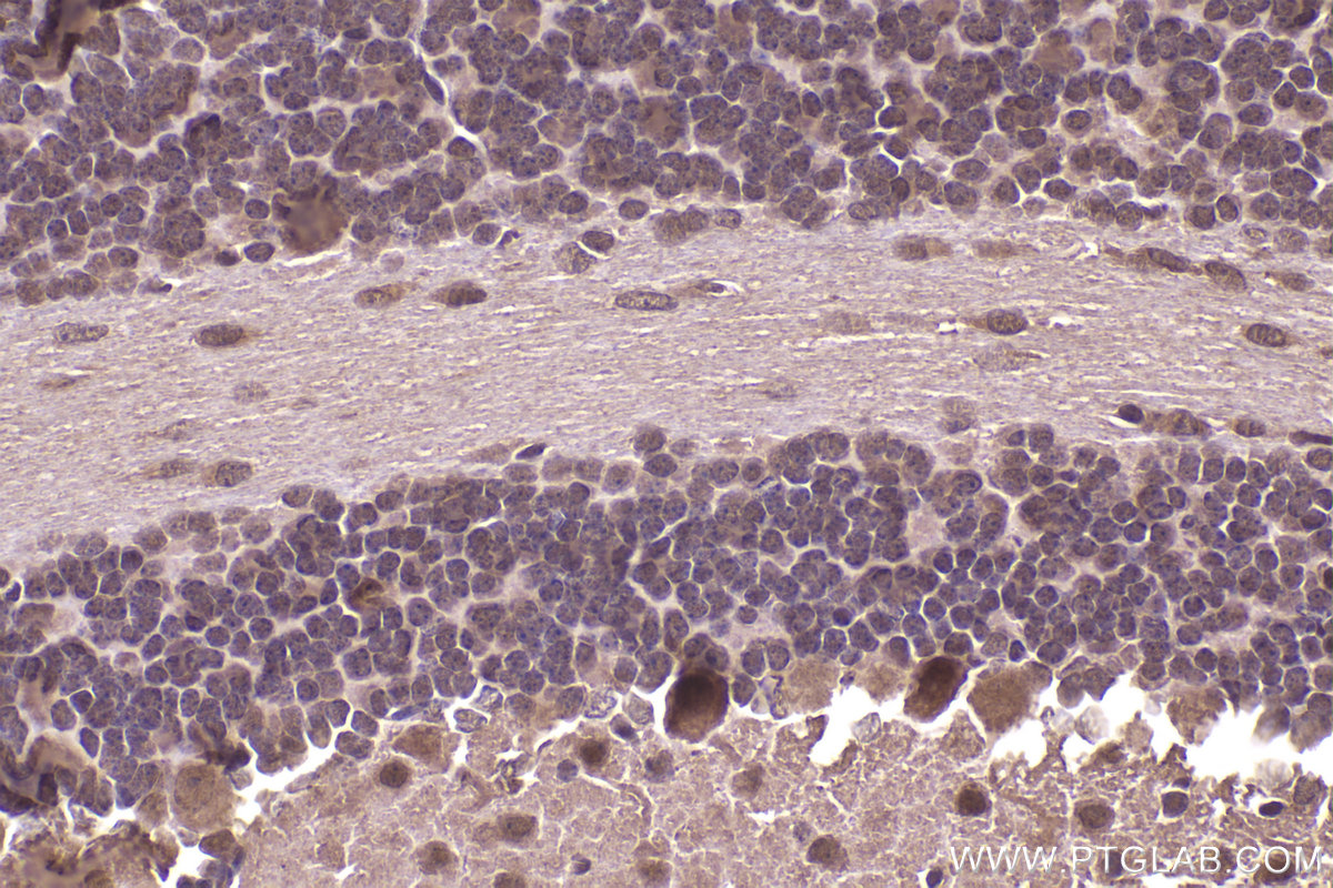 Immunohistochemical analysis of paraffin-embedded mouse cerebellum tissue slide using KHC2346 (CSNK1A1 IHC Kit).