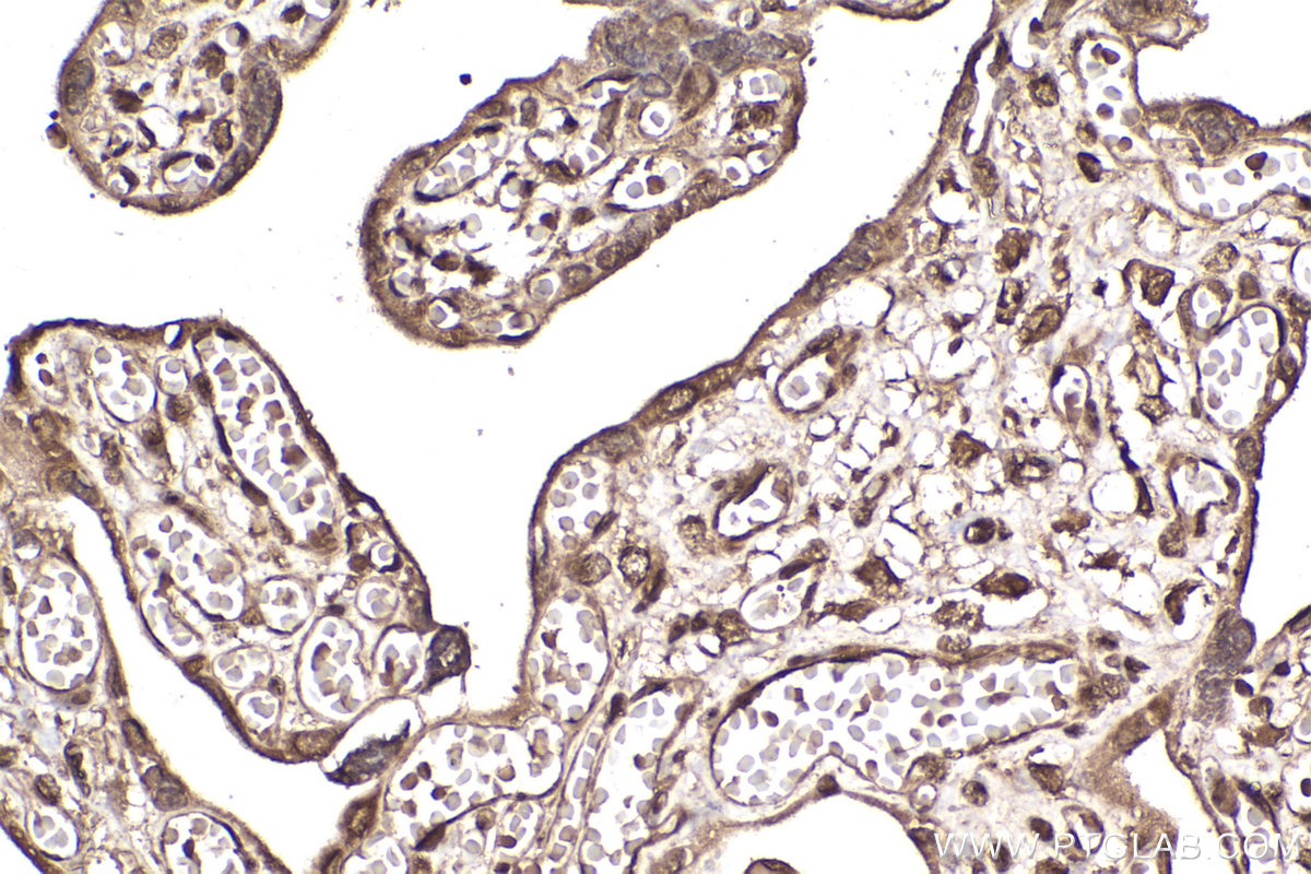 Immunohistochemical analysis of paraffin-embedded human placenta tissue slide using KHC2346 (CSNK1A1 IHC Kit).