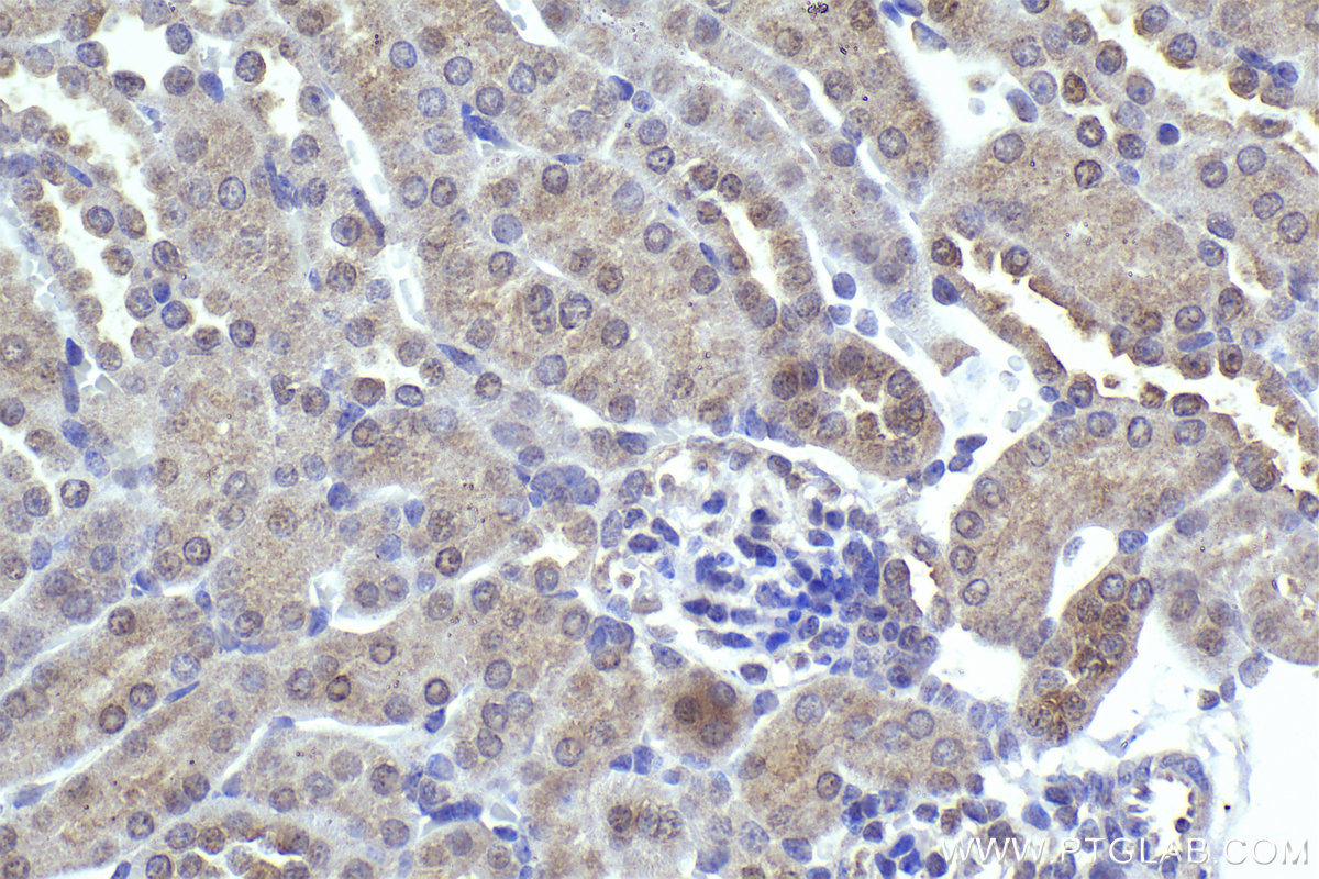 Immunohistochemical analysis of paraffin-embedded mouse kidney tissue slide using KHC2289 (CSNK1E IHC Kit).