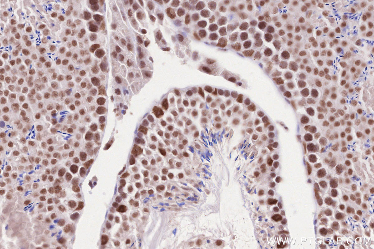 Immunohistochemical analysis of paraffin-embedded mouse testis tissue slide using KHC2587 (CTR9 IHC Kit).