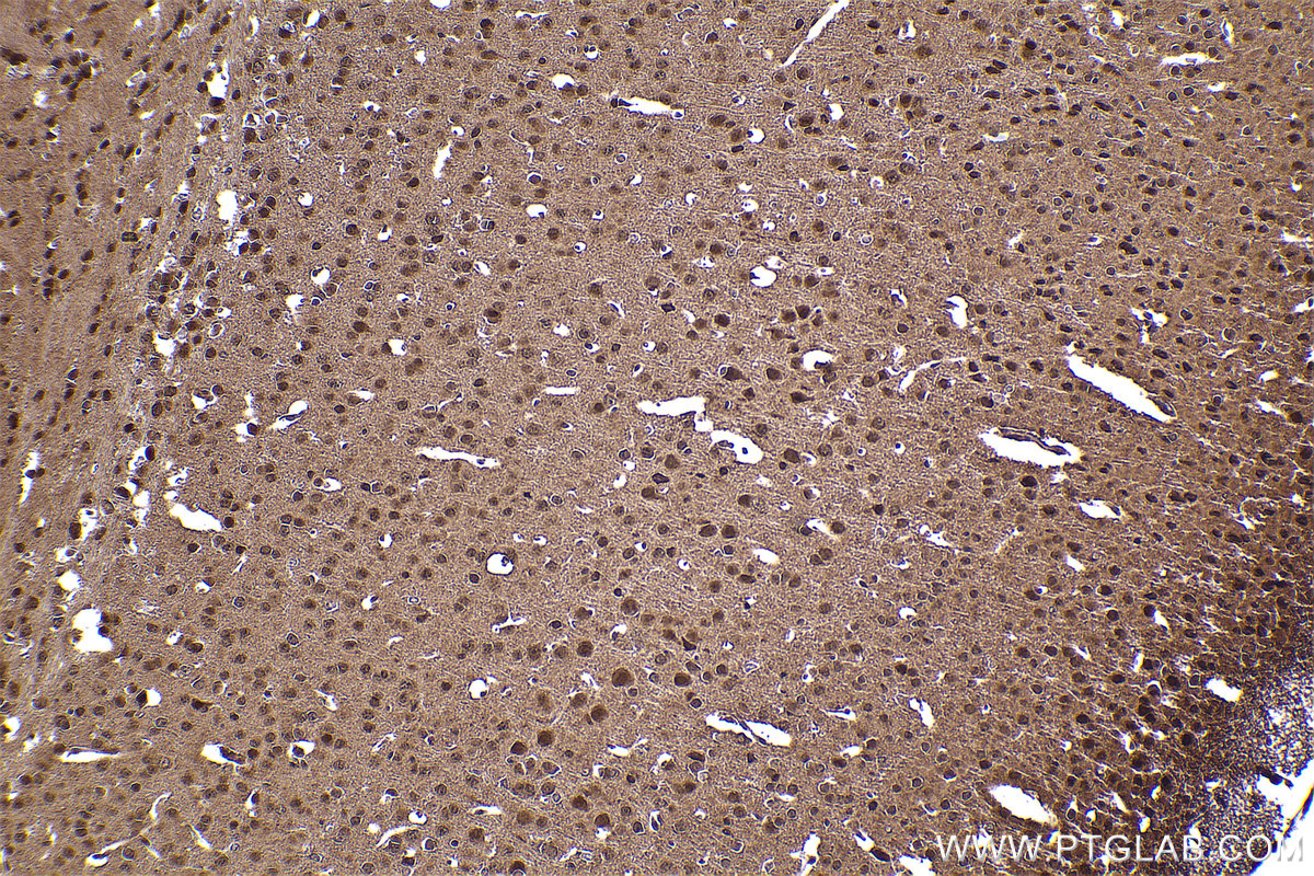 Immunohistochemical analysis of paraffin-embedded mouse brain tissue slide using KHC2437 (CUL2 IHC Kit).