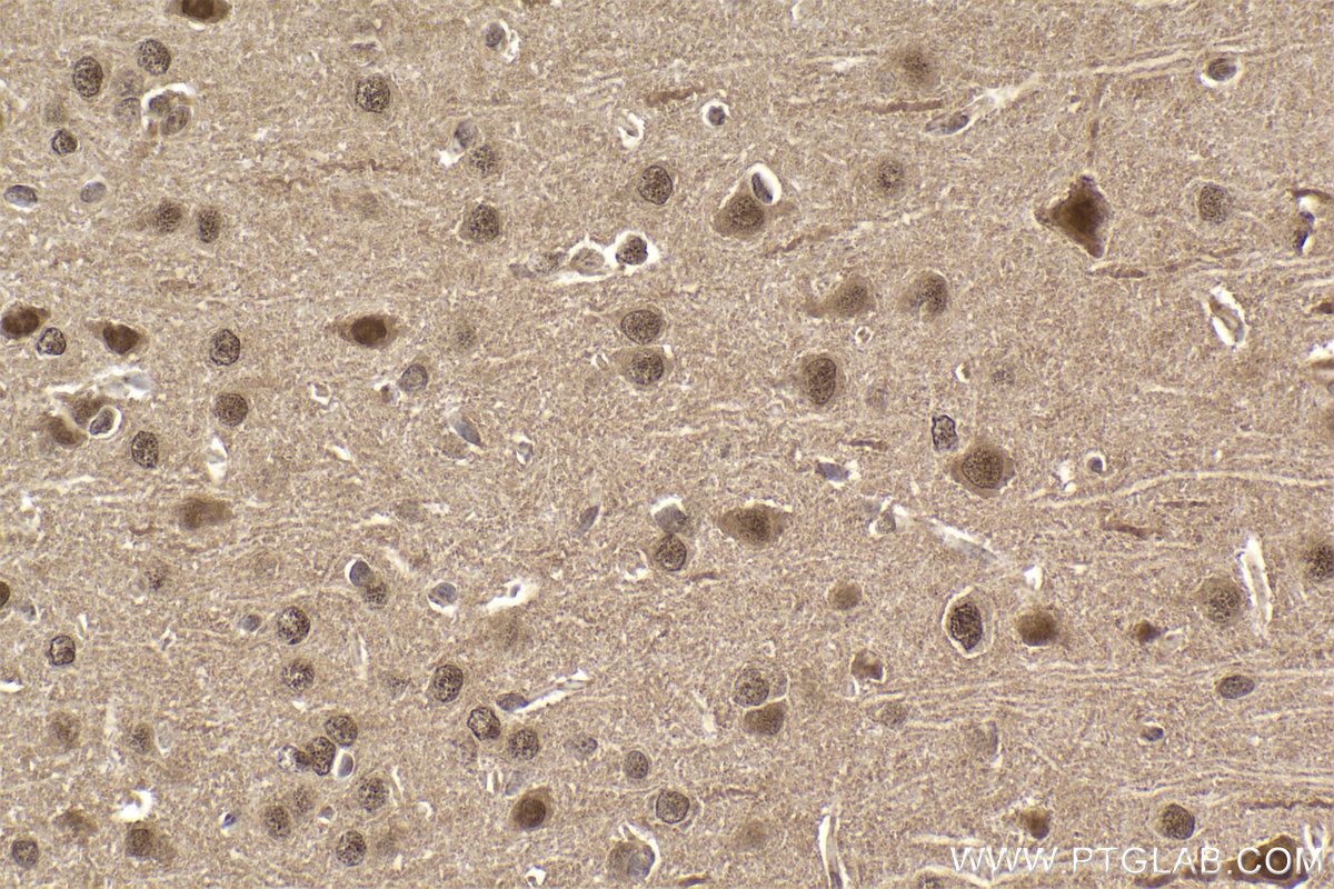 Immunohistochemical analysis of paraffin-embedded rat brain tissue slide using KHC2437 (CUL2 IHC Kit).