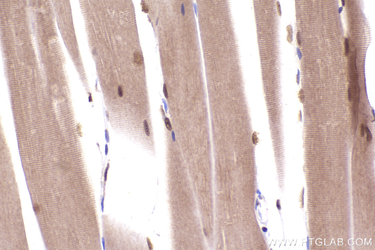 Immunohistochemical analysis of paraffin-embedded mouse skeletal muscle tissue slide using KHC2438 (CUL4A IHC Kit).