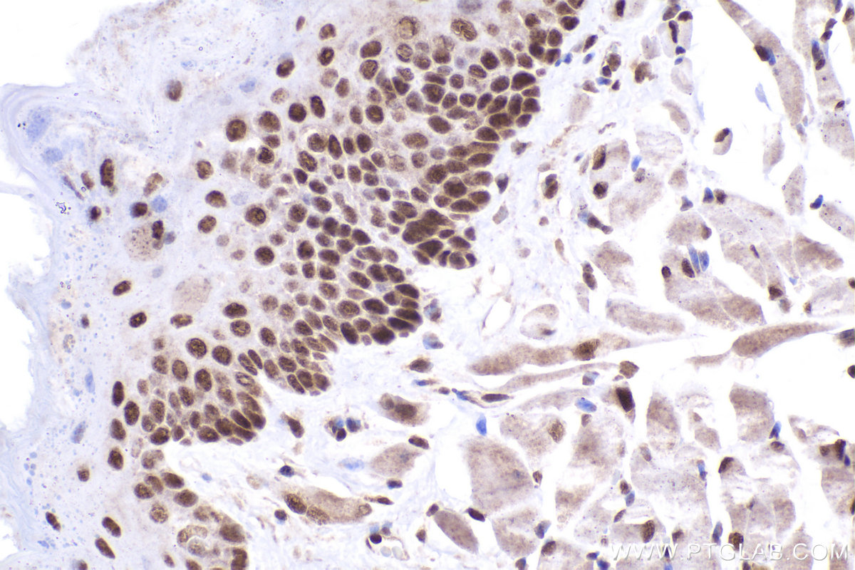 Immunohistochemical analysis of paraffin-embedded mouse tongue tissue slide using KHC2438 (CUL4A IHC Kit).