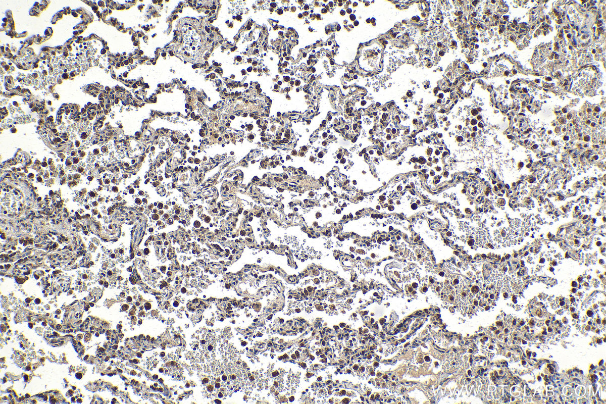 Immunohistochemical analysis of paraffin-embedded human lung tissue slide using KHC2157 (CYP1A1 IHC Kit).