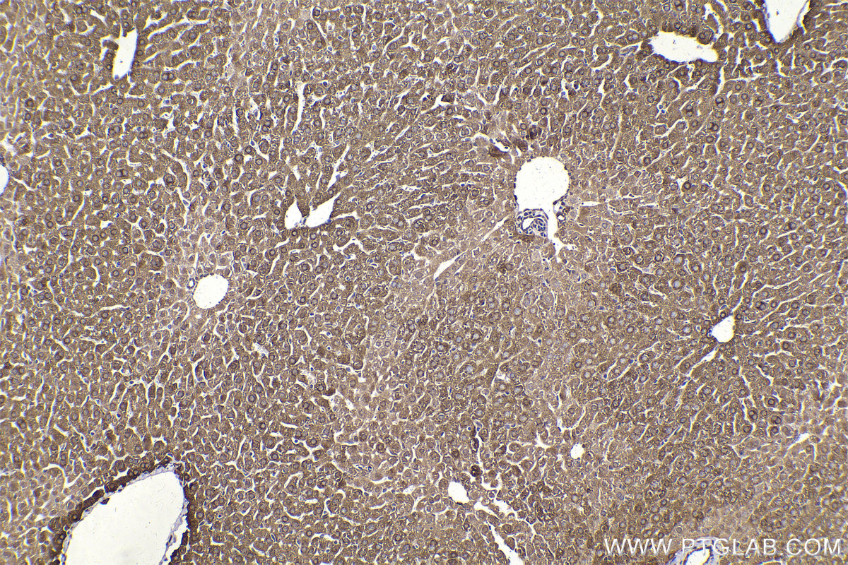 Immunohistochemical analysis of paraffin-embedded mouse liver tissue slide using KHC2157 (CYP1A1 IHC Kit).