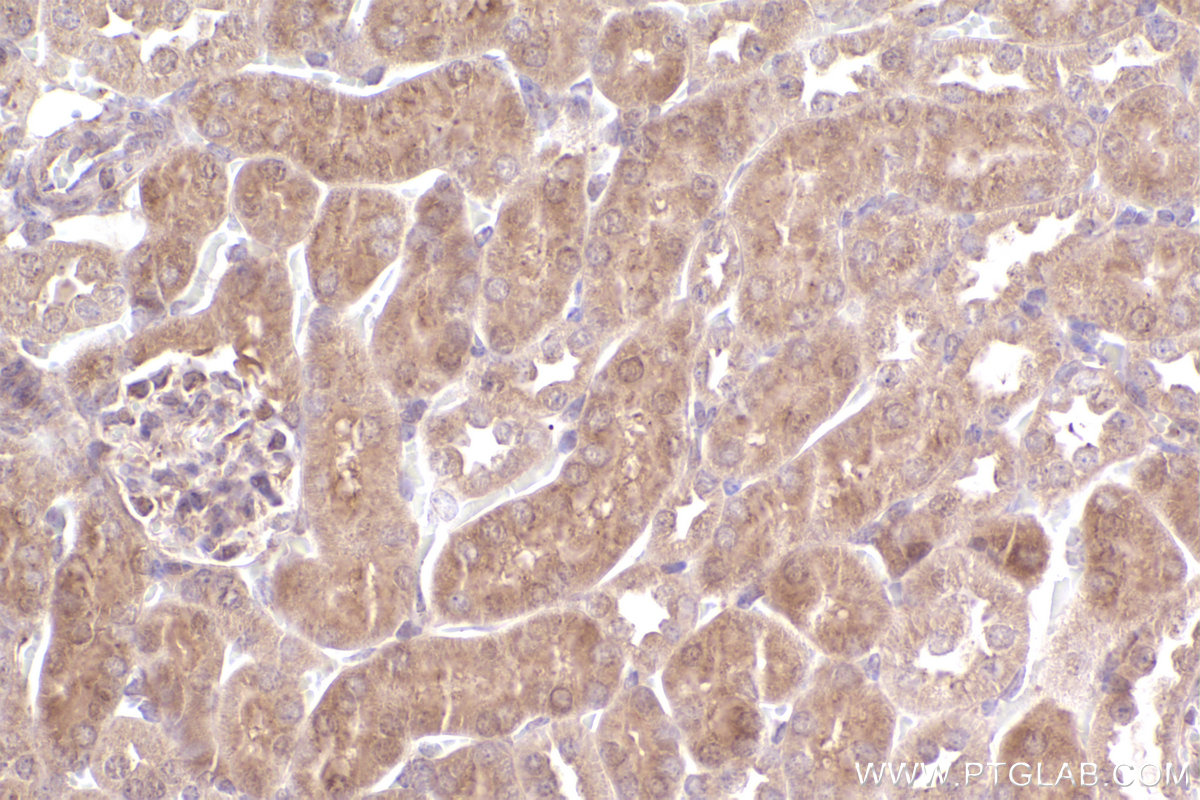 Immunohistochemical analysis of paraffin-embedded mouse kidney tissue slide using KHC2505 (CYP1B1 IHC Kit).