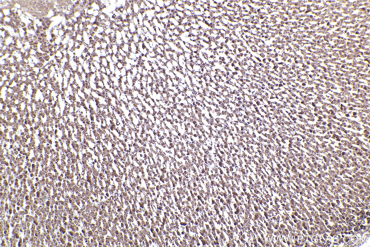 Immunohistochemical analysis of paraffin-embedded rat adrenal gland tissue slide using KHC2503 (Cryptochrome 1/CRY1 IHC Kit).