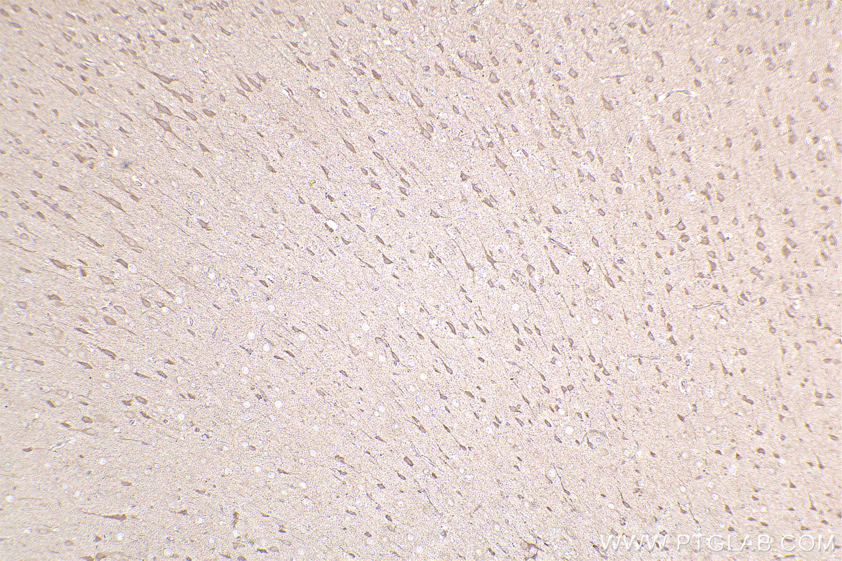 Immunohistochemical analysis of paraffin-embedded rat brain tissue slide using KHC2503 (Cryptochrome 1/CRY1 IHC Kit).