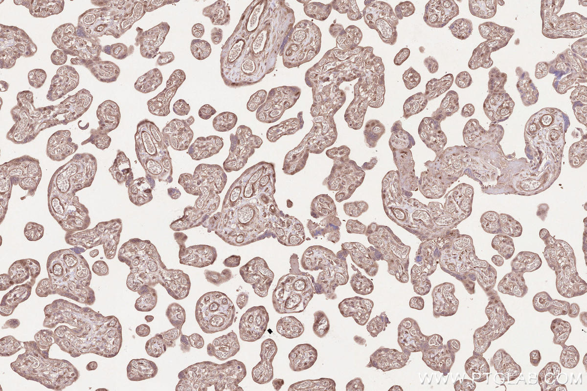 Immunohistochemical analysis of paraffin-embedded human placenta tissue slide using KHC2564 (DAB2IP IHC Kit).