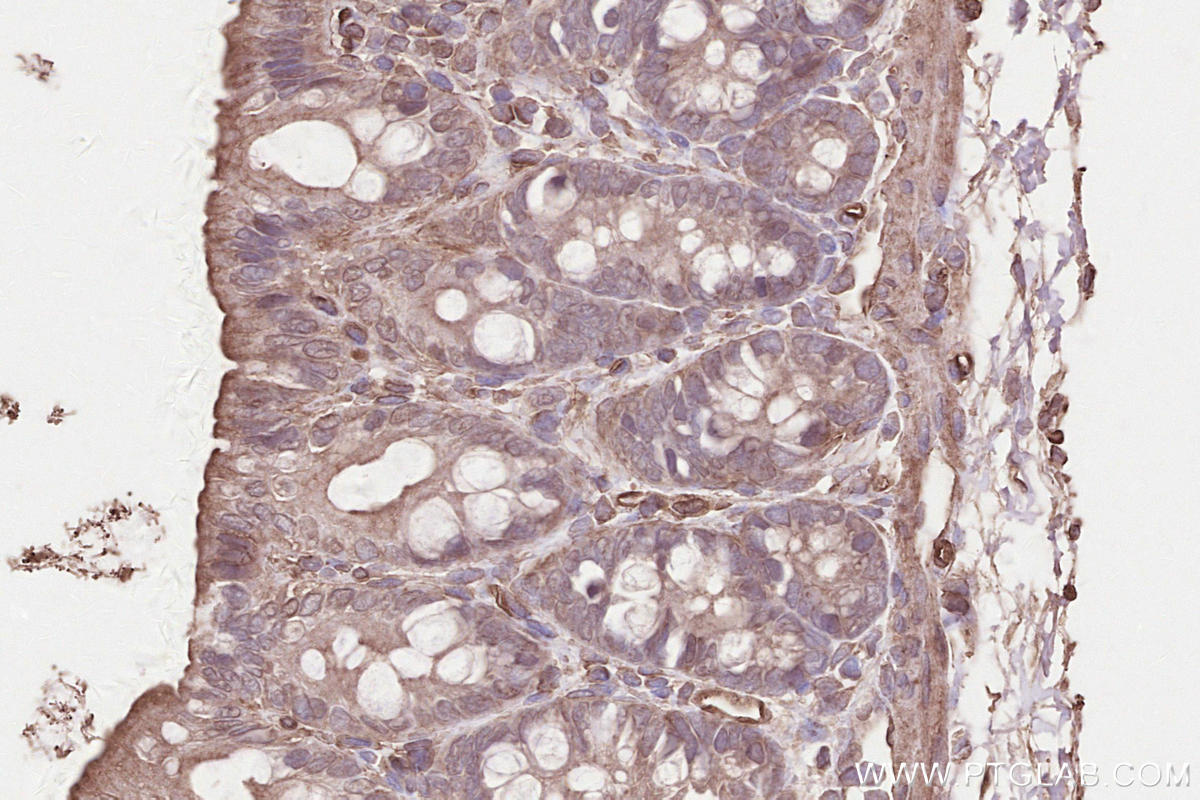 Immunohistochemical analysis of paraffin-embedded rat colon tissue slide using KHC2564 (DAB2IP IHC Kit).