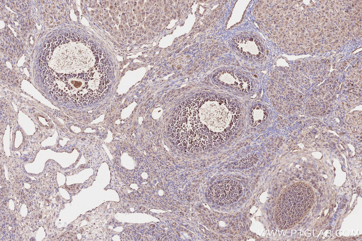 Immunohistochemical analysis of paraffin-embedded rat ovary tissue slide using KHC2564 (DAB2IP IHC Kit).