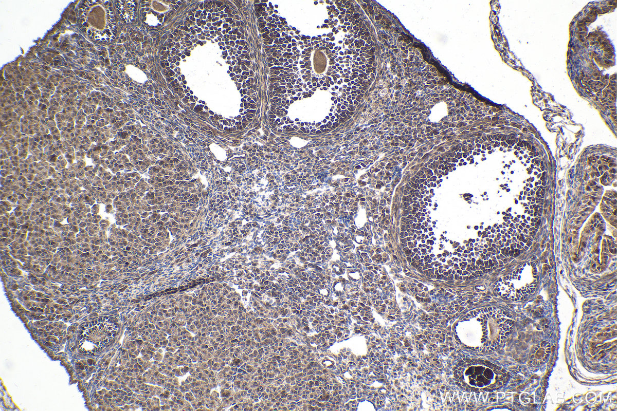 Immunohistochemical analysis of paraffin-embedded mouse ovary tissue slide using KHC1972 (DACT1 IHC Kit).