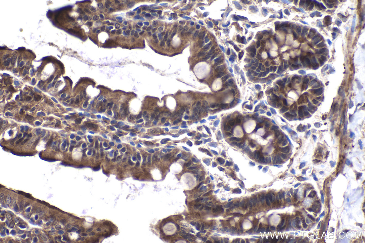 Immunohistochemical analysis of paraffin-embedded rat small intestine tissue slide using KHC1972 (DACT1 IHC Kit).
