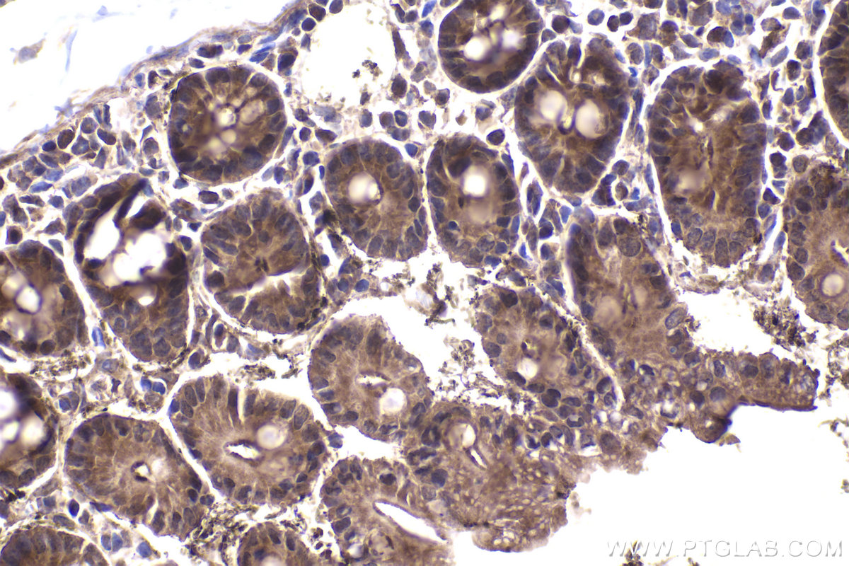 Immunohistochemical analysis of paraffin-embedded mouse small intestine tissue slide using KHC1972 (DACT1 IHC Kit).